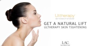 Ultherapy