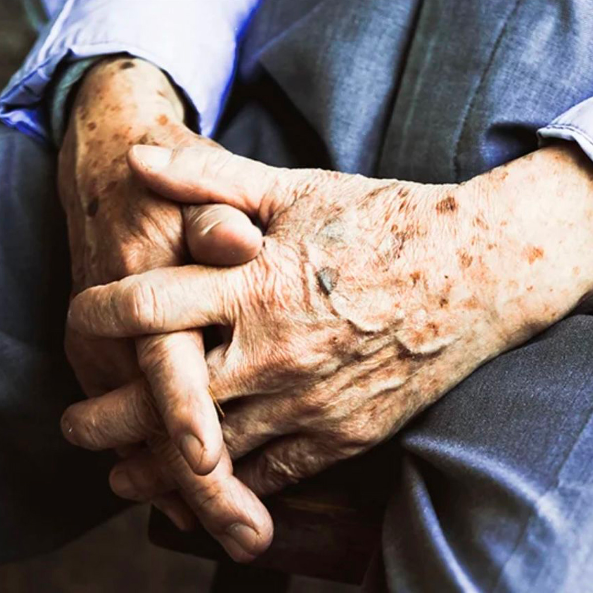 Elderly Person'S Hands With Brown Spots