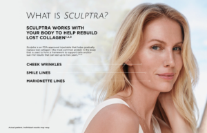 Sculptra