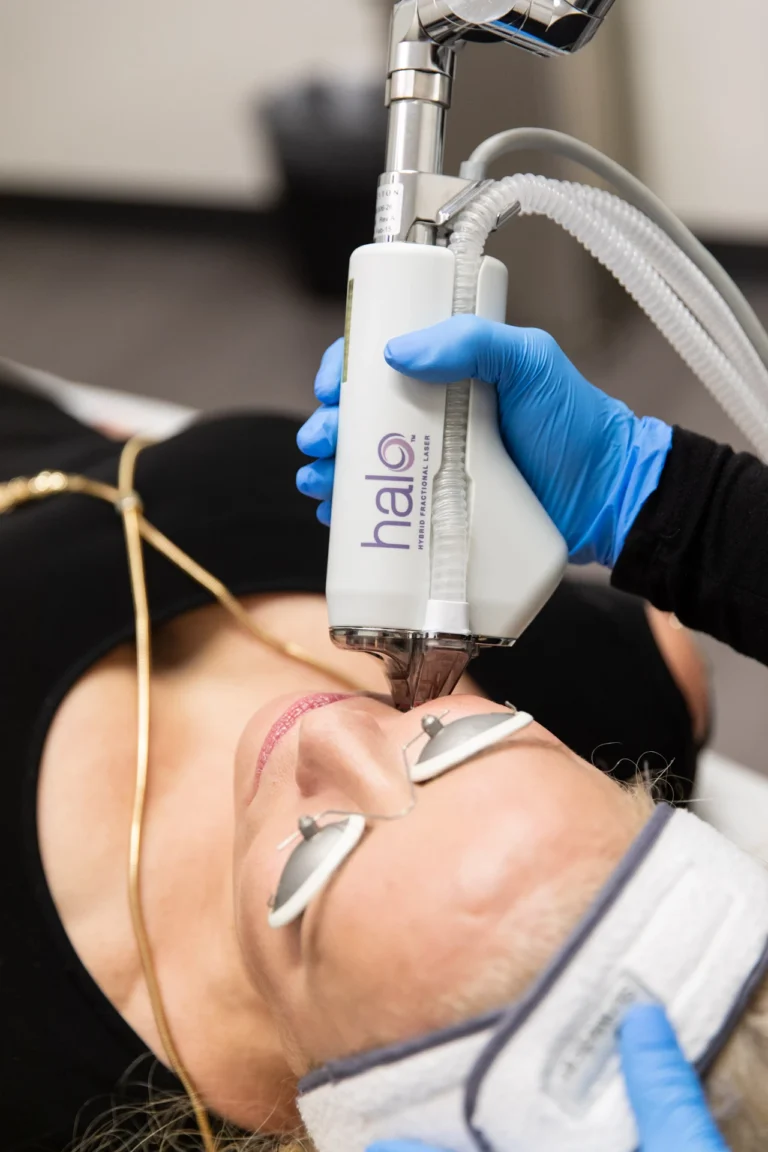 Halo Laser Treatment