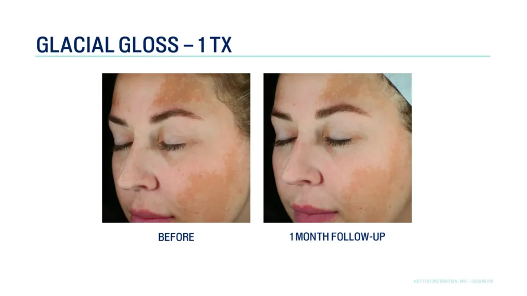 Glacial Rx At Art Of Skin