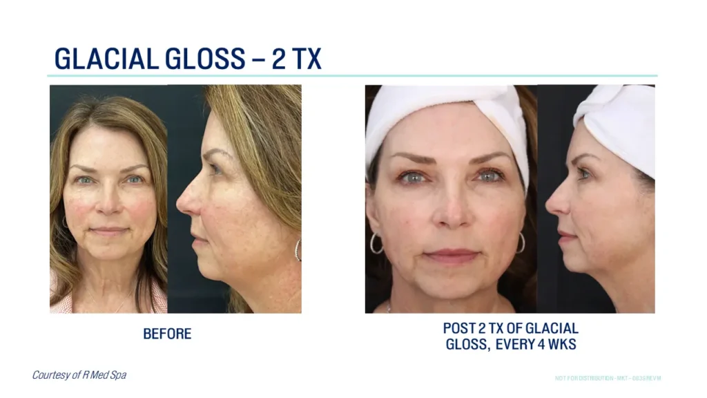 Glacial Rx At Art Of Skin