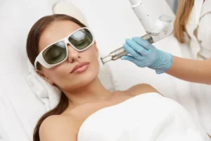 Juvedérm Laser Treatment