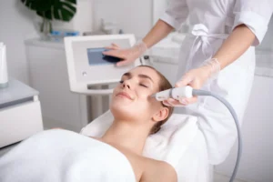 Microneedling With Prp Facial